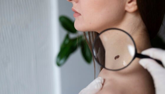 Apgamų šalinimas chirurginiu būdu